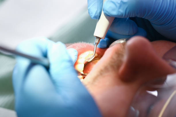 Best Urgent Tooth Repair  in Erwin, TN
